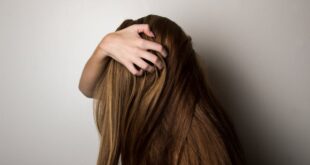 CMMA BLOG News | 6 Cara Mengatasi Rambut Rontok Berlebihan Agar Kembali Sehat